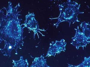 Cientistas israelenses dizem ter achado a 'cura definitiva' para o câncer