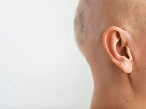 Homem arranca as próprias orelhas para simular tortura e voltar para ex, mas polícia descobre farsa