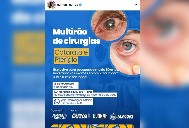 Aliados de JHC, Mesaque e Gunnar haviam anunciado mutirão de cirurgias patrocinado por Paulo Dantas
