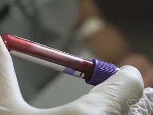 Licitação de laboratório envolvido em infecção por HIV será investigada