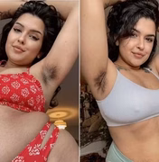 Ex-estudante de medicina faz 'fortuna' com pelos nas axilas e critica Kim Kardashian