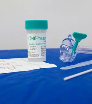 Guia orienta sobre mudança no rastreamento do câncer de colo do útero