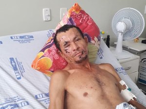 Hospital de Emergência do Agreste procura familiares de “Quebra-Pedra”