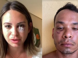 Médico diz que está com ‘emocional destruído’ após briga em resort na Bahia