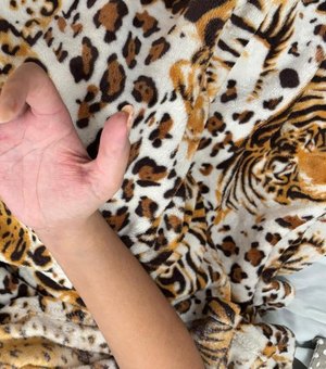 Jovem de 20 anos é internada no Hospital Metropolitano após colocar unhas em gel