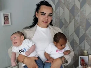 Mulher dá à luz gêmeos com tons de pele completamente diferentes