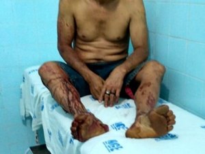 Colônia Leopoldina tem dois assassinatos e dois atentados no fim de semana