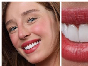 Duda Reis comemora lentes de contato nos dentes: 'Amei demais!'