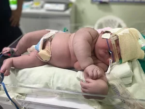 'Bebê Gigante' nasce com mais de 7 kg em maternidade de Parintins, no interior do AM