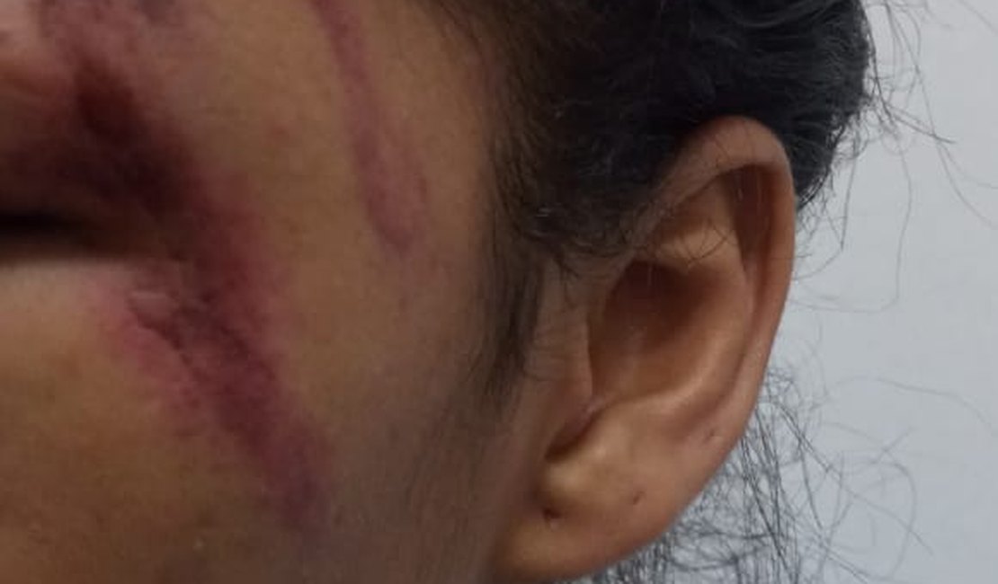 Homem é preso após agredir mulher com socos no rosto, em Maceió