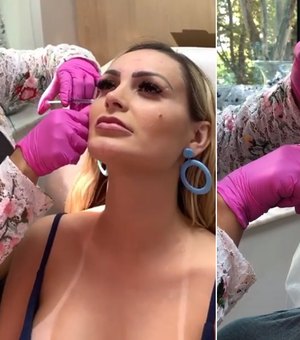 Andressa Urach faz botox com o marido: 'Ficar mais lindo para mim'