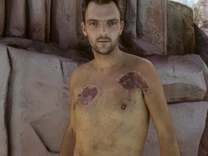 Homem é mordido por tubarão e diz que foi salvo após chegada de golfinhos