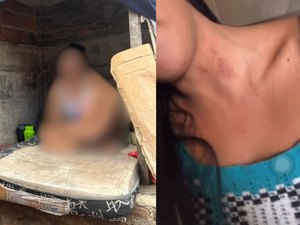 Adolescente diz que usava 'casinha de cachorro' para fumar e nega tortura: 'é um chupão'