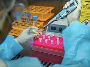 Mortes por Covid-19 caem 12% no Brasil, mas números ainda assustam