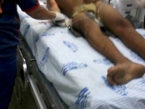 Adolescente que sofreu tentativa de homicídio morre na UE