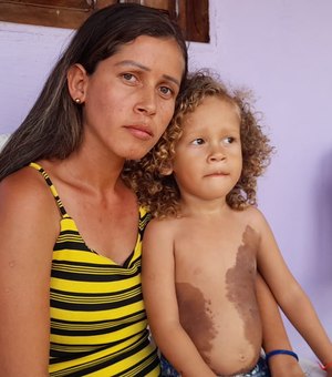 Mãe pede ajuda para filho passar por segundo procedimento cirúrgico avaliado em R$ 10 mil