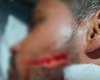Jovem é atingido por facada no rosto durante vaquejada em Delmiro Gouveia