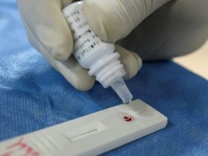 Arapiraca tem 114 novos casos de Covid-19 e chega a 2.437 infectados
