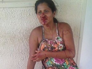 Grávida é agredida com barra de ferro no Sertão