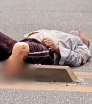 Homem é atropelado por moto e sofre fratura exposta na Av. Menino Marcelo