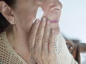 Dermatologista da Sesau orienta sobre os cuidados para evitar o câncer de pele no verão