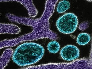 OMS confirma morte por vírus Nipah em Bangladesh