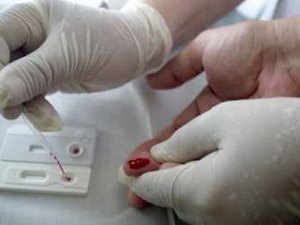 Em Arapiraca já foram notificados 34 casos de Aids