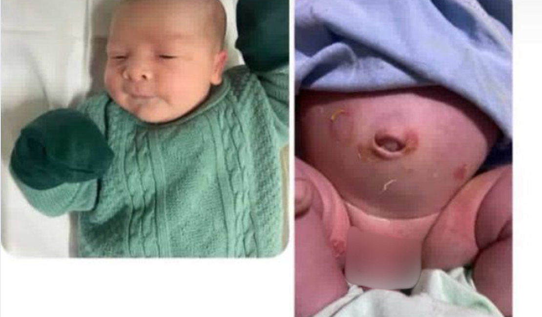 Mãe denuncia que recém-nascido contraiu bactéria após alta do Hospital Regional de Arapiraca