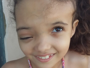 Criança de oito anos precisa de doações de Sangue A+ para realizar uma cirurgia de reconstrução facial