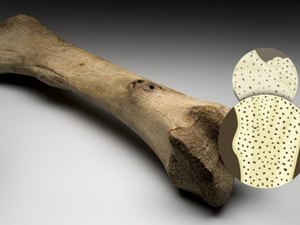 Antibiótico barato criado há mais de 50 anos reverte início de osteoporose