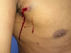 Agente penitenciário e duas pessoas são baleadas em atentado na parte alta de Maceió