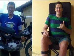 Homem mais alto do Brasil faz cirurgia para amputar perna nesta terça-feira (7)