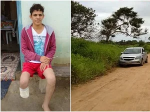 Servidor que amputou o próprio pé alegou que perdeu membro em sequestro