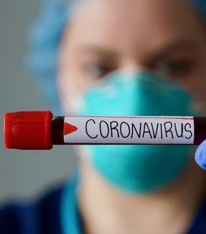 Governo recomenda cancelamento de eventos por causa do coronavírus