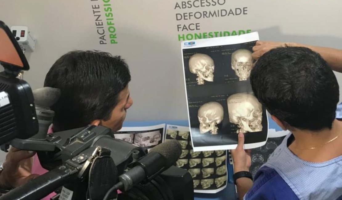 Hospital de Arapiraca é o primeiro do Brasil em cirurgias de face