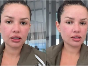 Juliette mostra rosto após procedimento com esperma de salmão; veja