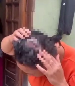 [Vídeo] Mulher é atacada com facão por ex- marido e leva 20 pontos na cabeça em Junqueiro