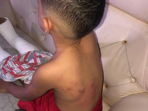 Mãe é presa suspeita de espancar filho de 6 anos por ele ter urinado no chão