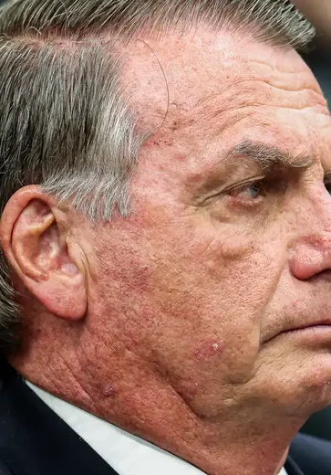 Médico diz que Bolsonaro está ‘fragilizado’: ‘Tem comido menos do que gostaríamos’