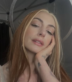 Catarata precoce deixou Anne Hathaway 'praticamente cega' por dez anos