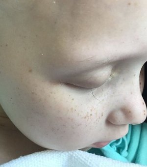 Pai fotografa último fio dos cílios de filha que enfrenta câncer