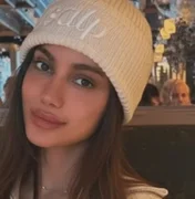 Anitta aparece com rosto diferente e web reage. Veja antes e depois