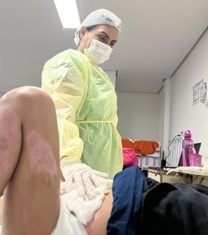 HGE alerta para os riscos causados por queimaduras e recomenda atenção também dentro de casa