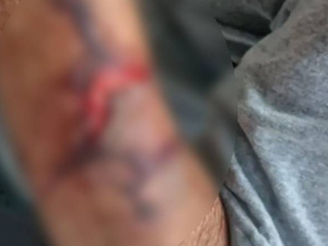 Idoso de 82 anos é agredido com capacetadas durante roubo de R$ 10 mil em Delmiro Gouveia