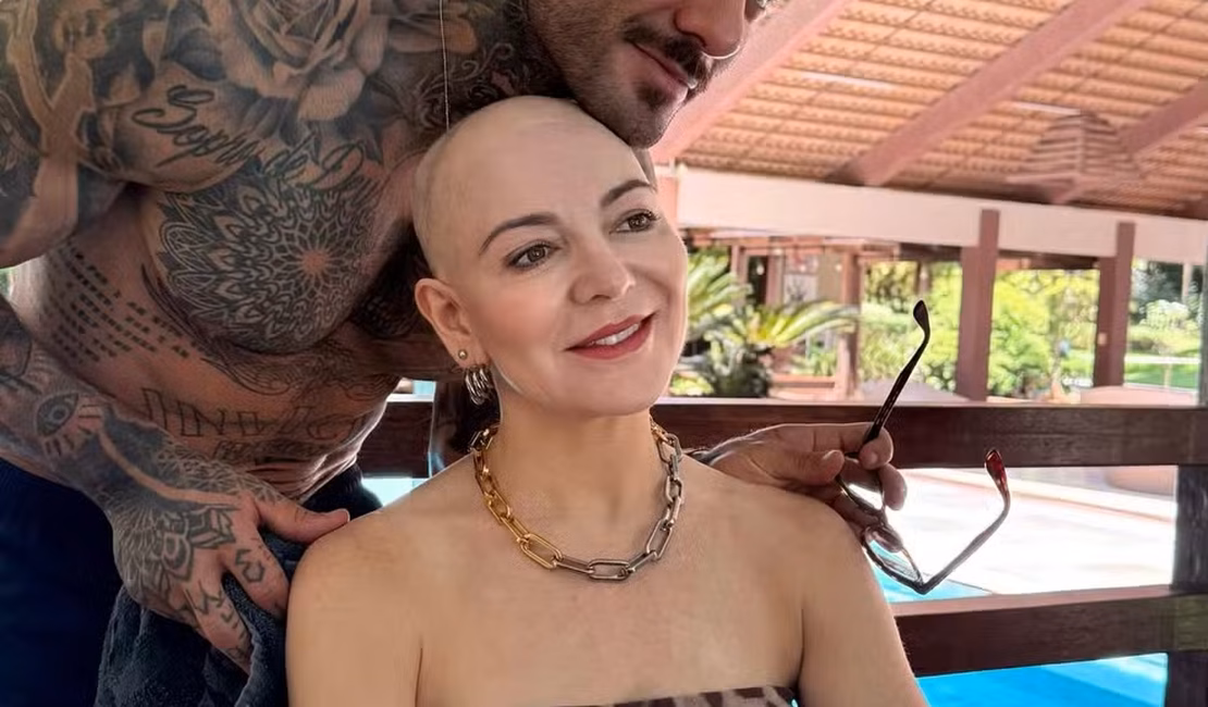 Mãe de Lucas Lucco fala sobre mensagens recebidas após diagnóstico de alopecia areata: 'Não é sobre estética'