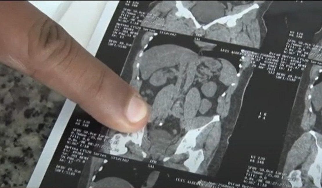 Paciente renal pede ajuda para realizar cirurgia urgente em Maceió