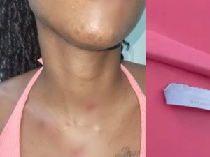 Mulher escapa de ser morta a facadas em Maceió após faca quebrar; ex foi preso