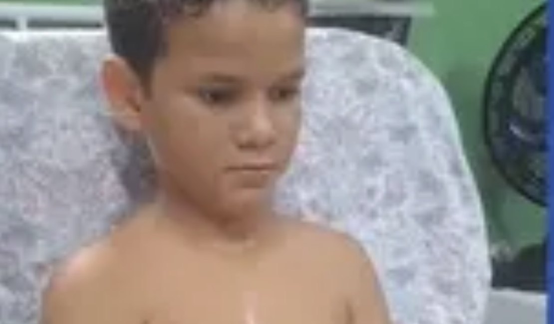 Menino de 10 anos tem parte do braço amputada após acidente na BR-316, em Maribondo