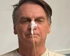 Bolsonaro tem piora de saúde; web se apavora com últimas notícias