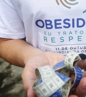 Jovem a partir dos 14 anos passa a poder fazer cirurgia bariátrica